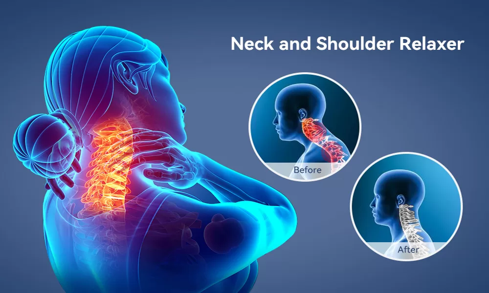 Neck and Shoulder Relaxer for TMJ Pain Relief Illustration 1